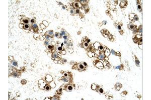 Immunohistochemistry (IHC) image for anti-UNC Homeobox (UNCX) (C-Term) antibody (ABIN2783013) (UNCX 抗体  (C-Term))