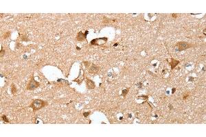Immunohistochemistry of paraffin-embedded Human brain using CAPG Polyclonal Antibody at dilution of 1:40 (CAPG 抗体)
