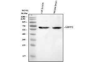 anti-Membrane Protein, Palmitoylated 2 (MAGUK P55 Subfamily Member 2) (MPP2) (AA 387-576) antibody