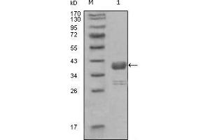 Western blot analysis using ABL1 mouse mAb against truncated GST-ABL1 recombinant protein (1). (ABL1 抗体  (AA 577-650))