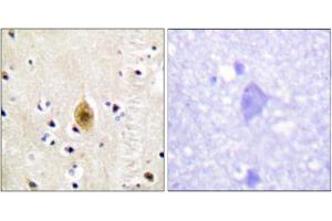 Immunohistochemical staining of paraffin-embedded human brain tissue reacted with STK4/STK3 (phospho T183) polyclonal antibody  at 1:50-1:100 dilution. (STK4 抗体  (pThr183))