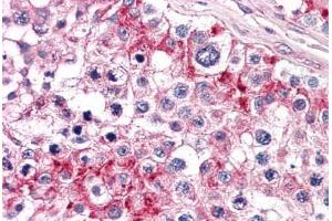 Human Testis: Formalin-Fixed, Paraffin-Embedded (FFPE) (TLN1 抗体  (AA 1052-1150))