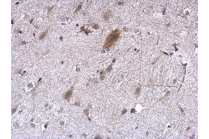 IHC-P Image EEF1E1 antibody [N1C3] detects EEF1E1 protein at cytoplasm on mouse fore brain by immunohistochemical analysis. (EEF1E1 抗体)