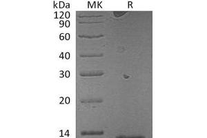 Western Blotting (WB) image for S100 Calcium Binding Protein A7A (S100A7A) protein (ABIN7320634) (S100A7A 蛋白)