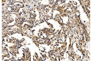 IHC analysis of Profilin 2/PFN2 using anti-Profilin 2/PFN2 antibody (ABIN7602692).