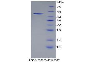 SDS-PAGE (SDS) image for Pancreatic Polypeptide (PPY) (AA 31-97) protein (His tag,GST tag) (ABIN2123442) (PPY Protein (AA 31-97) (His tag,GST tag))