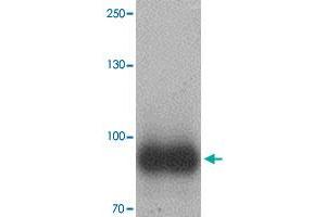 Western blot analysis of IL17RE in human ovary tissue with IL17RE polyclonal antibody  at 1 ug/mL. (IL17RE 抗体  (Internal Region))