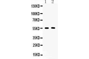 Western blot analysis of CD147/Emmprin using anti-CD147/Emmprin antibody . (CD147 抗体  (AA 138-323))