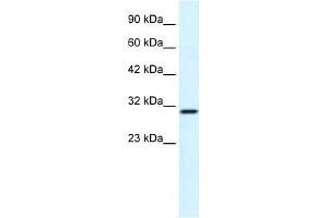 WB Suggested Anti-FLJ20729 Antibody Titration:  1. (FLJ20729 (C-Term) 抗体)