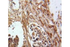 Used in DAB staining on fromalin fixed paraffin-embedded Ovary tissue (Inhibin alpha 抗体  (AA 25-363))