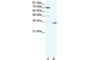 Western Blotting (WB) image for anti-Melanoma Antigen Family A, 9 (MAGEA9) antibody (ABIN2461754) (MAGEA9 抗体)
