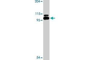 Western blot analysis of TLR6 expression in Jurkat cell lysate with TLR6 polyclonal antibody  at 2 ug/mL . (TLR6 抗体  (Internal Region))