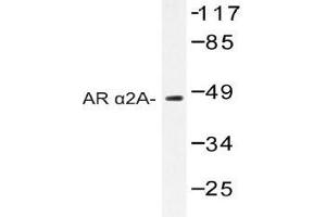 Western blot (WB) analysis of AR alpha2A antibody in extracts from Jurkat cells. (ADRA2A 抗体)
