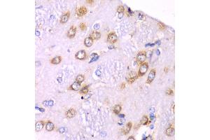 Immunohistochemistry of paraffin-embedded rat brain using RPS3A Antibody. (RPS3A 抗体)