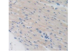 IHC-P analysis of Mouse Heart Tissue, with DAB staining. (LSR 抗体  (AA 35-205))