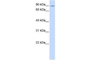 ATP2C1 antibody used at 1 ug/ml to detect target protein. (ATP2C1 抗体  (C-Term))