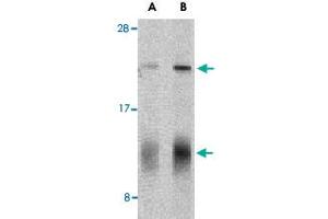 Western blot analysis of IL32 in human spleen tissue lysate with IL32 polyclonal antibody  at (A) 5 and (B) 10 ug/mL shows two isoforms of IL-32. (IL32 抗体  (C-Term))