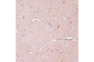 Immunohistochemistry of paraffin-embedded mouse brain using CD82 antibody (ABIN6131855, ABIN6138233, ABIN6138234 and ABIN6218884) at dilution of 1:100 (40x lens). (CD82 抗体  (C-Term))