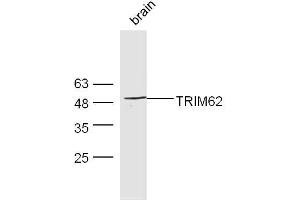 Mouse brain lysates probed with Rabbit Anti-TRIM62 Polyclonal Antibody, Unconjugated  at 1:300 overnight at 4˚C.