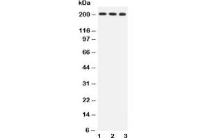 Western blot testing of BRCA1 antibody and Lane 1:  HeLa;  2: MCF-7;  3: A549 lysate (BRCA1 抗体  (AA 1661-1863))