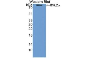 Western blot analysis of the recombinant protein. (Vitamin D-Binding Protein 抗体  (AA 17-476))