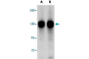 Western blot analysis of FAM120A in SK-N-SH cell lysate with FAM120A polyclonal antibody  at (A) 0. (FAM120A 抗体  (Internal Region))
