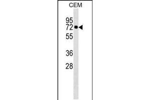 Western blot analysis in CEM cell line lysates (35ug/lane). (KLHL28 抗体  (C-Term))