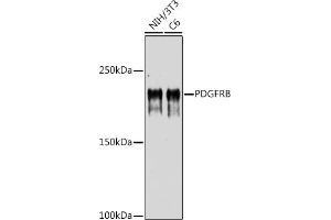 Western blot analysis of extracts of various cell lines, using PDGFRB antibody (ABIN6134579, ABIN6145372 and ABIN7101437) at 1:1000 dilution. (PDGFRB 抗体)