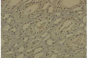 Immunohistochemistry analysis using Mouse Anti-DNMT1 Monoclonal Antibody, Clone 60B1220. (DNMT1 抗体  (AA 637-650) (HRP))