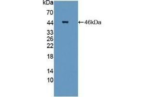Detection of Recombinant STAM2, Mouse using Polyclonal Antibody to Signal Transducing Adaptor Molecule 2 (STAM2) (STAM2 抗体  (AA 1-377))