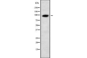 Western blot analysis UNC5A using Jurkat whole cell lysates (UNC5A 抗体  (Internal Region))