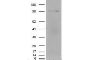 Western blot analysis of LXR in lysates of cells that were transfected with the pCMV6-ENTRY control or pCMV6-ENTRY NR1H3 cDNA using NR1H3/NR1H2 polyclonal antibody . (NR1H3 抗体  (AA 50-150))