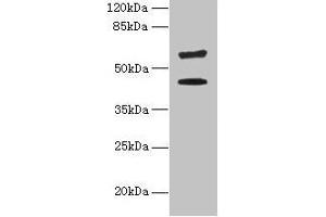 Western blot All lanes: KRT73 antibody at 4 μg/mL + HepG2 whole cell lysate Secondary Goat polyclonal to rabbit IgG at 1/10000 dilution Predicted band size: 59, 42 kDa Observed band size: 59, 42 kDa (KRT73 抗体  (AA 1-300))