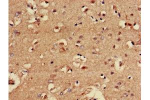 Immunohistochemistry of paraffin-embedded human brain tissue using ABIN7147705 at dilution of 1:100 (CBX5 抗体  (AA 1-191))