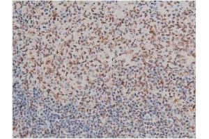Immunohistochemistry (IHC) image for anti-GATA Binding Protein 1 (Globin Transcription Factor 1) (GATA1) (pSer142) antibody (ABIN6254982)