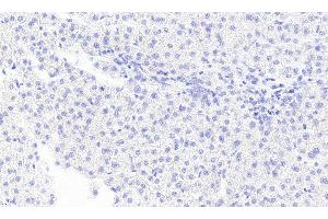 ABIN334436 Negative Control showing staining of paraffin embedded Human Liver, with no primary antibody. (MGLL 抗体  (Internal Region))
