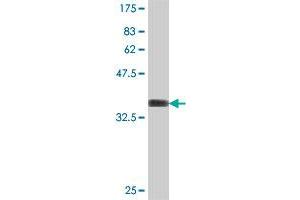 Western Blot detection against Immunogen (37 KDa) . (Rhotekin 抗体  (AA 451-549))