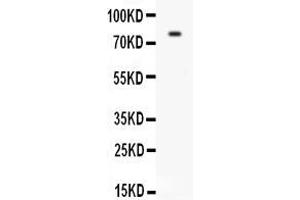 Anti-CD31 antibody, ,Western blottingAll lanes: Anti CD31  at 0. (CD31 抗体  (C-Term))