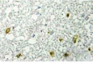 Immunohistochemistry (IHC) analyzes of FoxE1 antibody in paraffin-embedded human RAW264. (FOXE1 抗体)