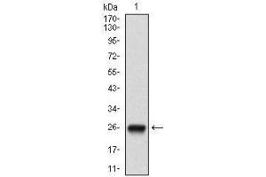 Western blot analysis using NT5E mAb against human NT5E (AA: ) recombinant protein.