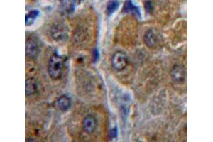 Used in DAB staining on fromalin fixed paraffin-embedded Liver tissue (ACP1 抗体  (AA 1-158))