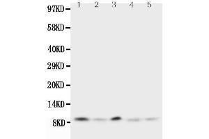 Anti-Ubiquitin antibody, Western blotting Lane 1: Rat Thymus Tissue Lysate Lane 2: Human MCF-7 Cell Lysate Lane 3: MM231 Cell Lysate Lane 4: HELA Cell Lysate Lane 5: SMMC Cell Lysate (Ubiquitin B 抗体  (N-Term))