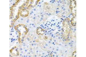 Immunohistochemistry of paraffin-embedded Rat kidney using STRN3 Polyclonal Antibody at dilution of 1:100 (40x lens). (STRN3 抗体)