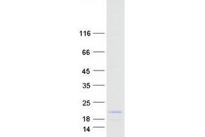 Validation with Western Blot