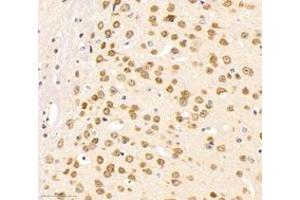 Immunohistochemistry of paraffin embedded mouse brain using neun (ABIN7075479) at dilution of 1: 500 (300x lens) (NeuN 抗体)