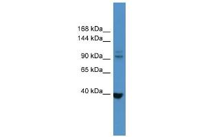 WB Suggested Anti-LTK Antibody Titration: 0. (LTK 抗体  (N-Term))