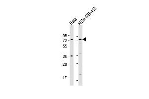 All lanes : Anti-CCDC81 Antibody (Center) at 1:500 dilution Lane 1: Hela whole cell lysate Lane 2: MDA-MB-453 whole cell lysate Lysates/proteins at 20 μg per lane. (CCDC81 抗体  (AA 380-408))