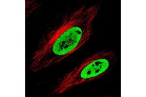 Immunofluorescent staining of HeLa cells with FUS monoclonal antibody, clone CL0190  (Green) shows clear nuclear (without nucleoli).