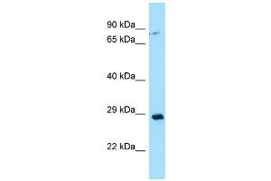 WB Suggested Anti-CA13 Antibody Titration: 1. (CA13 抗体  (N-Term))