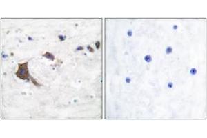 Immunohistochemistry analysis of paraffin-embedded human brain tissue, using ERAB Antibody. (HSD17B10 抗体  (AA 111-160))